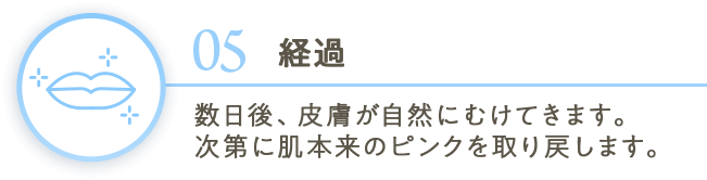 05経過 数日後、皮膚が自然にむけてきます。次第に肌本来のピンクを取り戻します。
