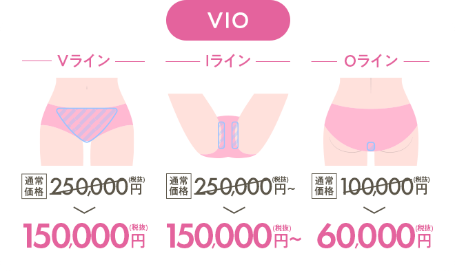 vio Vライン 250,000円 →150,000円 Iライン 250,000円 →150,000円 Iライン 100,000円 →60,000円